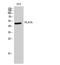 Phospholipase A1 member A antibody, STJ95148, St John