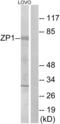 Zona Pellucida Glycoprotein 1 antibody, LS-C120490, Lifespan Biosciences, Western Blot image 