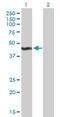 ALG2 Alpha-1,3/1,6-Mannosyltransferase antibody, H00085365-B01P, Novus Biologicals, Western Blot image 