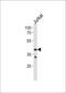 Trace Amine Associated Receptor 2 (Gene/Pseudogene) antibody, PA5-35263, Invitrogen Antibodies, Western Blot image 