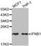 Interferon Beta 1 antibody, A1575, ABclonal Technology, Western Blot image 