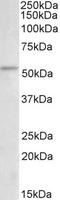 Checkpoint Kinase 1 antibody, LS-C204989, Lifespan Biosciences, Western Blot image 