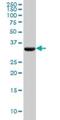 Pyruvate Dehydrogenase E1 Beta Subunit antibody, H00005162-M03, Novus Biologicals, Western Blot image 