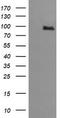 Phosphoinositide-3-Kinase Regulatory Subunit 5 antibody, TA505815S, Origene, Western Blot image 