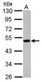 Keratin 36 antibody, NBP2-17039, Novus Biologicals, Western Blot image 