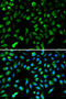 NME/NM23 Nucleoside Diphosphate Kinase 1 antibody, 13-111, ProSci, Immunofluorescence image 