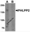 PH Domain And Leucine Rich Repeat Protein Phosphatase 2 antibody, 7021, ProSci, Western Blot image 