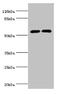 Cytochrome P450 Family 2 Subfamily E Member 1 antibody, CSB-PA006425EA01HU, Cusabio, Western Blot image 