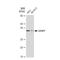 Insulin Like Growth Factor Binding Protein 7 antibody, GTX03198, GeneTex, Western Blot image 