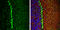 Protein Phosphatase 1 Regulatory Inhibitor Subunit 1B antibody, GTX133336, GeneTex, Immunohistochemistry frozen image 