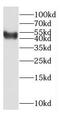 Potassium Calcium-Activated Channel Subfamily N Member 4 antibody, FNab04498, FineTest, Western Blot image 
