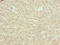 PHD Finger Protein 13 antibody, LS-C397128, Lifespan Biosciences, Immunohistochemistry paraffin image 