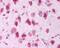 Leucine Rich Repeat Kinase 2 antibody, PA1-16990, Invitrogen Antibodies, Immunohistochemistry frozen image 