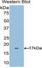 ADAM Metallopeptidase With Thrombospondin Type 1 Motif 4 antibody, LS-C298077, Lifespan Biosciences, Western Blot image 