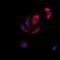 Mitogen-Activated Protein Kinase Kinase 6 antibody, LS-C368833, Lifespan Biosciences, Immunofluorescence image 