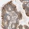 Putative MAPK-activating protein PM04/PM05/PM06/PM07 antibody, HPA009160, Atlas Antibodies, Immunohistochemistry frozen image 