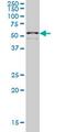 Zinc Finger Protein 136 antibody, MA5-20271, Invitrogen Antibodies, Western Blot image 