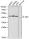 Lipase A, Lysosomal Acid Type antibody, A03895-1, Boster Biological Technology, Western Blot image 