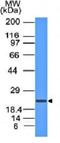 Cyclin-dependent kinase inhibitor 2A, isoform 1 antibody, orb178504, Biorbyt, Western Blot image 