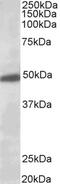 Potassium Voltage-Gated Channel Subfamily J Member 6 antibody, PA5-18802, Invitrogen Antibodies, Western Blot image 