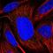 Transmembrane Protein 39B antibody, NBP1-83869, Novus Biologicals, Immunofluorescence image 