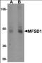 Major Facilitator Superfamily Domain Containing 1 antibody, orb94594, Biorbyt, Western Blot image 