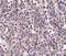 Epstein-Barr Virus Induced 3 antibody, A07190-1, Boster Biological Technology, Immunohistochemistry paraffin image 