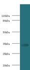 MHC class II RT1b antibody, MBS1488977, MyBioSource, Western Blot image 