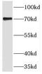 Tigger Transposable Element Derived 5 antibody, FNab08692, FineTest, Western Blot image 