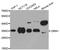 Alpha-1-acid glycoprotein antibody, orb48482, Biorbyt, Western Blot image 