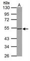 Thymidine Phosphorylase antibody, NBP1-31458, Novus Biologicals, Western Blot image 