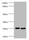 Tescalcin antibody, A57293-100, Epigentek, Western Blot image 