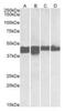 Creatine Kinase, M-Type antibody, orb99066, Biorbyt, Western Blot image 