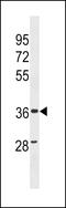 Zinc Finger CCCH-Type Containing, Antiviral 1 Like antibody, 60-689, ProSci, Western Blot image 