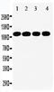 Signal Transducer And Activator Of Transcription 2 antibody, LS-C312668, Lifespan Biosciences, Western Blot image 