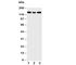 Insulin Like Growth Factor 1 Receptor antibody, R30838, NSJ Bioreagents, Western Blot image 