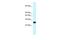 Homeobox B9 antibody, PA5-69005, Invitrogen Antibodies, Western Blot image 