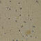 Arachidonate 5-Lipoxygenase antibody, 18-543, ProSci, Immunohistochemistry paraffin image 