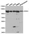 Histone Deacetylase 4 antibody, TA326791, Origene, Western Blot image 