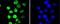 Ribosomal Protein S6 Kinase A5 antibody, NBP2-67653, Novus Biologicals, Immunocytochemistry image 