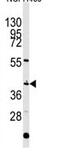 Engrailed Homeobox 1 antibody, ab70993, Abcam, Western Blot image 