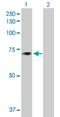 NME/NM23 Family Member 8 antibody, H00051314-B01P, Novus Biologicals, Western Blot image 