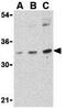BMI1 Proto-Oncogene, Polycomb Ring Finger antibody, GTX31296, GeneTex, Western Blot image 