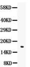 Angiogenin antibody, A00146, Boster Biological Technology, Western Blot image 