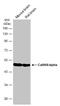 Calcium/Calmodulin Dependent Protein Kinase II Alpha antibody, GTX133071, GeneTex, Western Blot image 