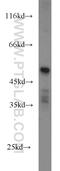 HtrA Serine Peptidase 4 antibody, 14095-1-AP, Proteintech Group, Western Blot image 