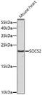 Suppressor Of Cytokine Signaling 2 antibody, GTX64538, GeneTex, Western Blot image 