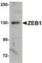 Zinc Finger E-Box Binding Homeobox 1 antibody, PA5-20979, Invitrogen Antibodies, Western Blot image 