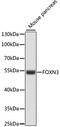 Forkhead Box N3 antibody, GTX66322, GeneTex, Western Blot image 