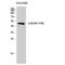 SLP-65 antibody, LS-C381276, Lifespan Biosciences, Western Blot image 